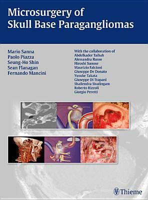 Microsurgery of Skull Base Paragangliomas by Seung-Ho Shin, Paolo Piazza, Mario Sanna