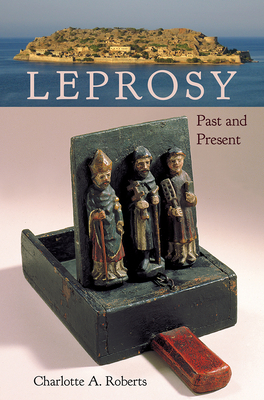 Leprosy: Past and Present by Charlotte A. Roberts