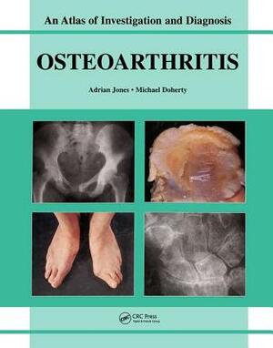 Oesteoarthritis: An Atlas of Investigation and Diagnosis by Michael Doherty, Adrian Jones