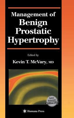 Management of Benign Prostatic Hypertrophy by 