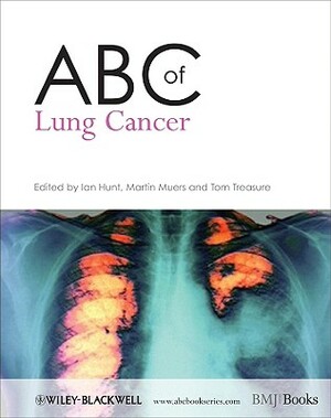 ABC of Lung Cancer by 