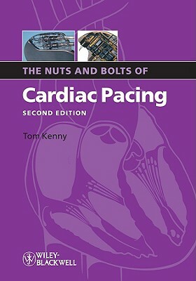 The Nuts and Bolts of Cardiac Pacing 2e by Tom Kenny