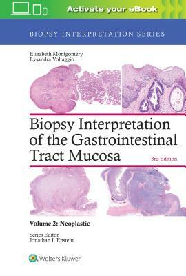 Biopsy Interpretation of the Gastrointestinal Tract Mucosa: Volume 2: Neoplastic by Elizabeth A. Montgomery, Lysandra Voltaggio