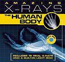 Amazing X-rays: The Human Body by Paul Beck