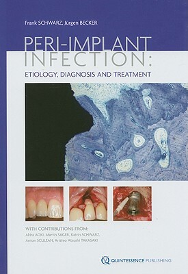 Peri-implant Infection: Etiology, Diagnosis and Treatment by Frank Schwarz, Jurgen Becker