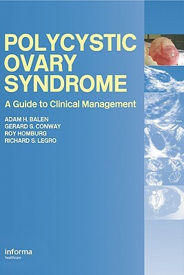 Polycystic Ovary Syndrome: A Guide to Clinical Management by 
