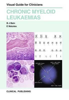 Chronic Myeloid Leukaemia by Bain