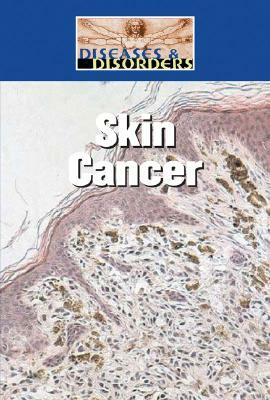 Skin Cancer by Bonnie Juettner