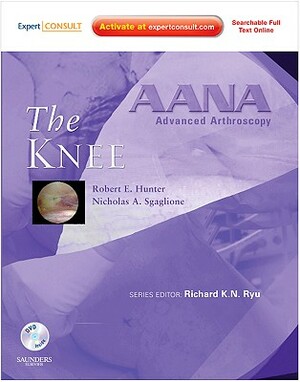 The Knee [With CDROM] by Nicholas A. Sgaglione, Robert E. Hunter