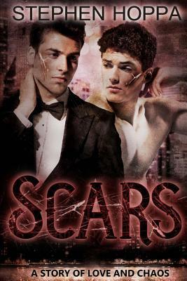 Scars by Stephen Hoppa