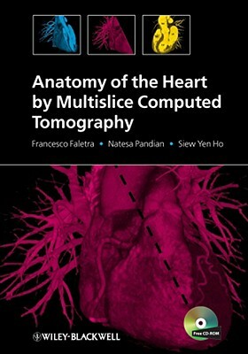 Anatomy of the Heart by Multislice Computed Tomography [With CDROM] by Natesa Pandian, Siew Yen Ho, Francesco Faletra