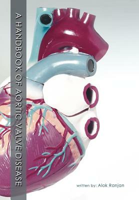 A Handbook of Aortic Valve Disease by Alok Ranjan