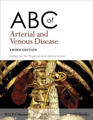 ABC of Arterial and Venous Disease by 