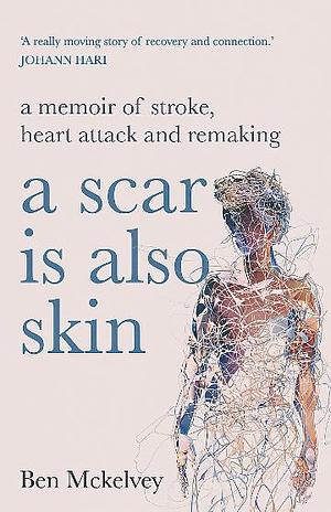 A Scar Is Also Skin: A Memoir of Stroke, Heart Attack and Remaking by Ben Mckelvey
