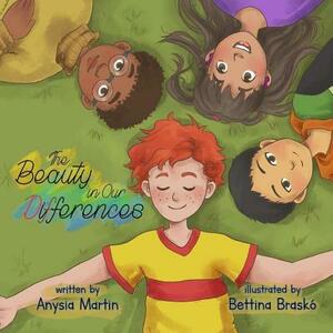 The Beauty in Our Differences by Anysia Martin