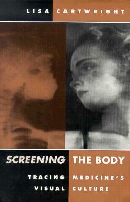 Screening the Body: Tracing Medicine's Visual Culture by Lisa Cartwright