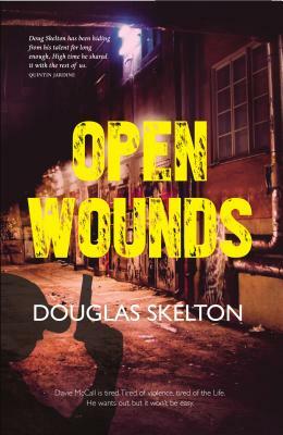 Open Wounds by Douglas Skelton