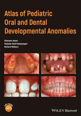 Atlas of Pediatric Oral and Dental Developmental Anomalies by Mojtaba Vahid Golpayegani, Ghassem Ansari, Richard Welbury