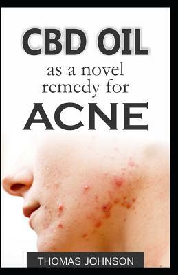 CBD Oil as a Novel Remedy for Acne by Thomas Johnson