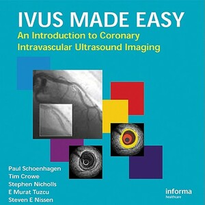 Ivus Made Easy by Stephen Nicholls, Tim Crowe, Paul Schoenhagen