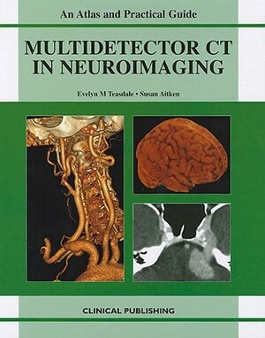 Multidetector CT in Neuroimaging: An Atlas and Practical Guide by Susan Aitken, Evelyn M. Teasdale