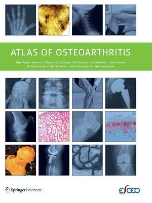 Atlas of Osteoarthritis by C. Cooper, Francisco Blanco, Nigel Arden