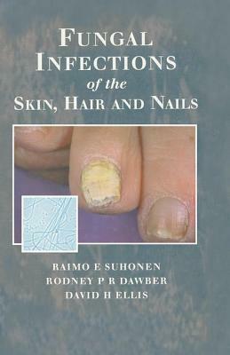 Fungal Infections of the Skin and Nails by Rodney P. R. Dawber, David H. Ellis, Raimo E. Suhonen