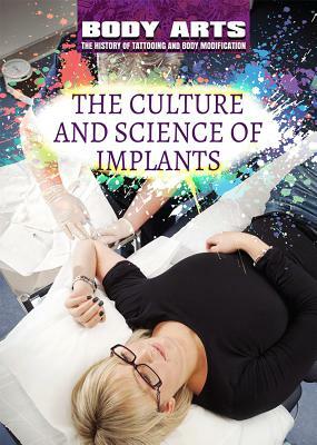 The Culture and Science of Implants by Monique Vescia