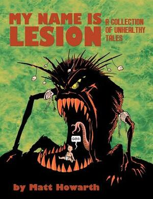 My Name Is Lesion: A Collection of Unhealthy Tales by Matt Howarth
