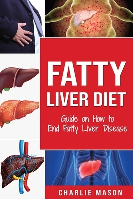 Fatty Liver Diet: Guide on How to End Fatty Liver Disease Fatty Liver Diet Books: Fatty Liver Diet (fatty liver diet for fatty liver Boo by Charlie Mason