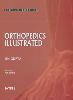 Orthopedics Illustrated by R. K. Gupta