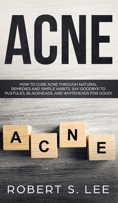 Acne: How to Cure Acne through Natural Remedies and Simple Habits. Say Goodbye to Pustules, Blackheads and Whiteheads for Go by Robert S. Lee