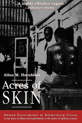 Acres of Skin: Human Experiments at Holmesburg Prison by Allen M. Hornblum