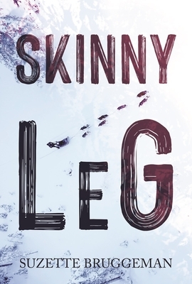 Skinny Leg by Suzette Bruggeman