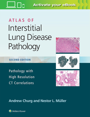 Atlas of Interstitial Lung Disease Pathology by Andrew Churg, Nestor L. Muller