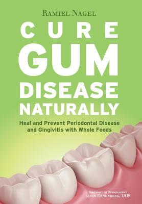 Cure Gum Disease Naturally: Heal Gingivitis and Periodontal Disease with Whole Foods by Ramiel Nagel