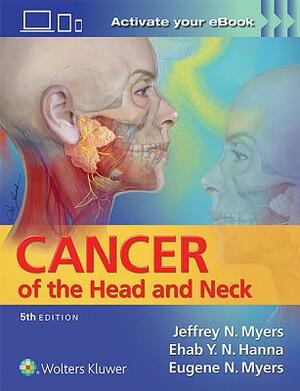 Cancer of the Head and Neck by Ehab Hanna, Jeffrey Myers