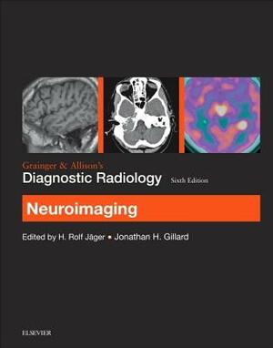 Grainger & Allison's Diagnostic Radiology: Neuroimaging by Jonathan H. Gillard, H. Rolf Jager