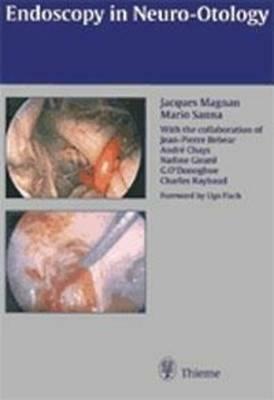 Endoscopy in Neuro-Otology and Skull Base Surgery (At): . Zus.-Arb.: Jacques Magnan, Mario Sanna with Contributions By... by Jacques Magnan, Jacques Magnan MD, Mario Sanna