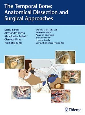 The Temporal Bone: Anatomical Dissection and Surgical Approaches by Abdelkader Taibah, Alessandra Russo, Mario Sanna