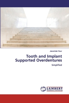 Tooth and Implant Supported Overdentures by Jaswinder Kaur