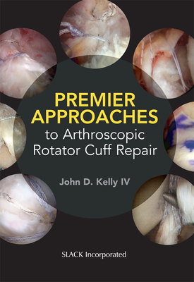 Premier Approaches to Arthroscopic Rotator Cuff Repair by John Kelly