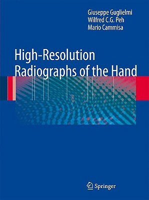 High-Resolution Radiographs of the Hand by Mario Cammisa, Wilfred C. G. Peh, Giuseppe Guglielmi