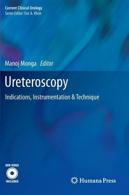 Ureteroscopy: Indications, Instrumentation & Technique by 