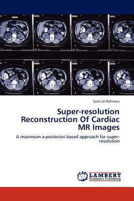 Super-Resolution Reconstruction of Cardiac MR Images by Sami Ur Rahman