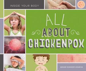 All about Chickenpox by Megan Borgert-Spaniol