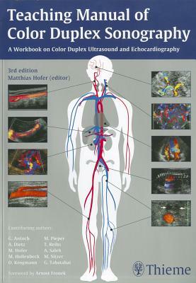 Teaching Manual of Color Duplex Sonography by Medidak Publishing Gmbh, Matthias Hofer